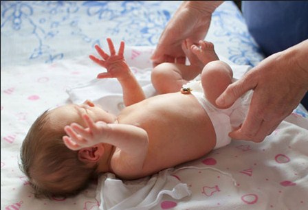 Cara Mengatasi Perut Kembung Pada Bayi Baru Lahir